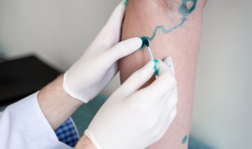 A Human Take on Vascular Surgery and the Roads Beneath Your Skin